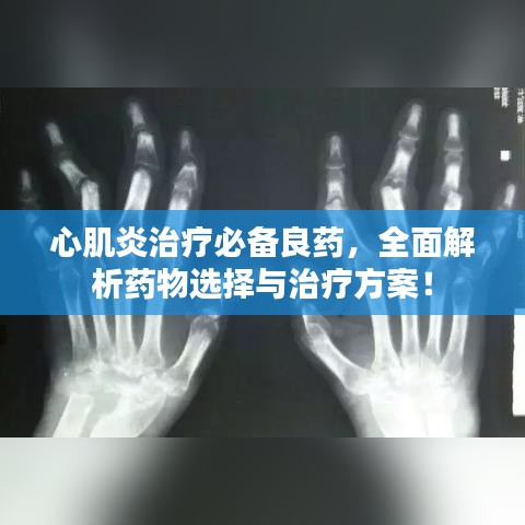心肌炎治疗必备良药，全面解析药物选择与治疗方案！
