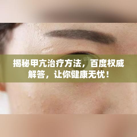 揭秘甲亢治疗方法，百度权威解答，让你健康无忧！