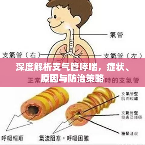深度解析支气管哮喘，症状、原因与防治策略
