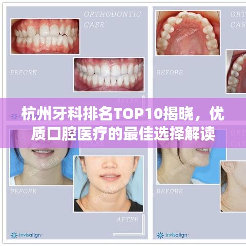 杭州牙科排名TOP10揭晓，优质口腔医疗的最佳选择解读