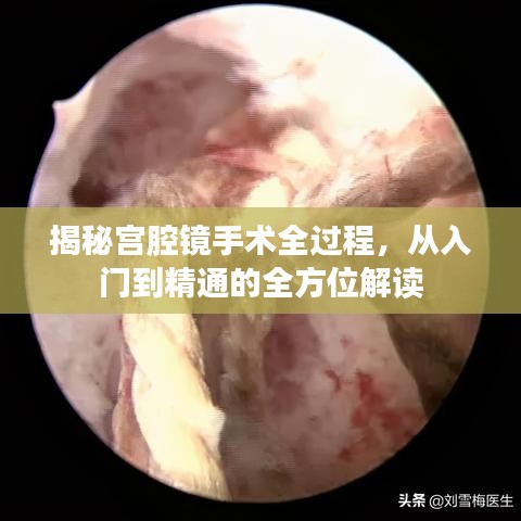 揭秘宫腔镜手术全过程，从入门到精通的全方位解读