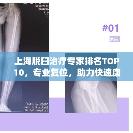 上海脱臼治疗专家排名TOP10，专业复位，助力快速康复