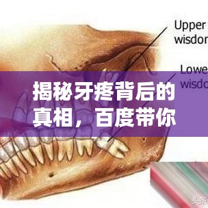 揭秘牙疼背后的真相，百度带你探索牙疼成因！