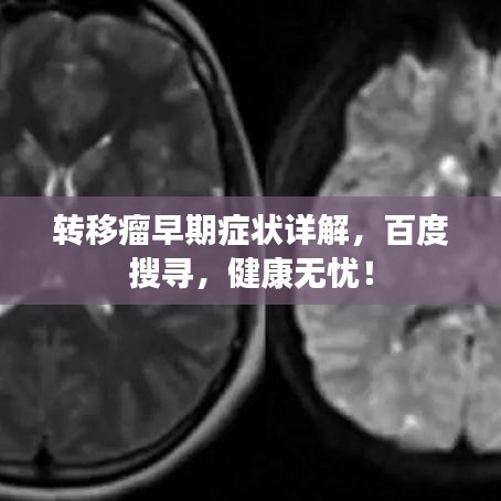 转移瘤早期症状详解，百度搜寻，健康无忧！