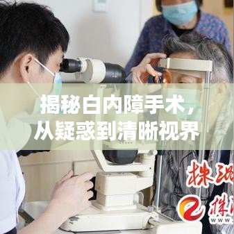 揭秘白内障手术,从疑惑到清晰视界,一站式解答您的所有问题