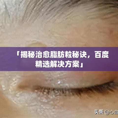 「揭秘治愈脂肪粒秘诀,百度精选解决方案」