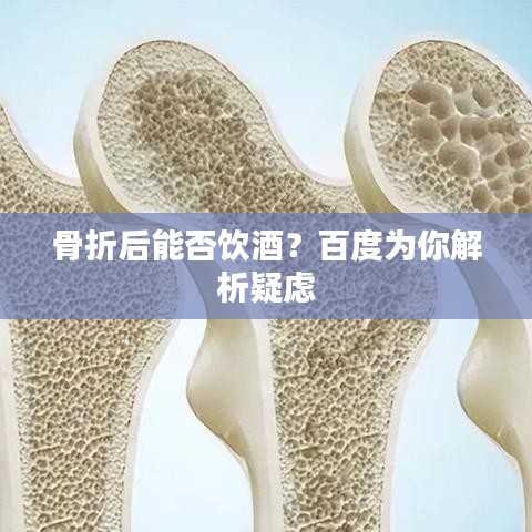 骨折后能否饮酒?百度为你解析疑虑